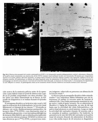 CLINICA QUIRURGICA - Cirugia pediatrica   ashcraft