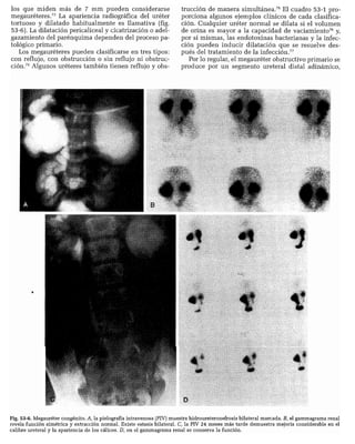 CLINICA QUIRURGICA - Cirugia pediatrica   ashcraft