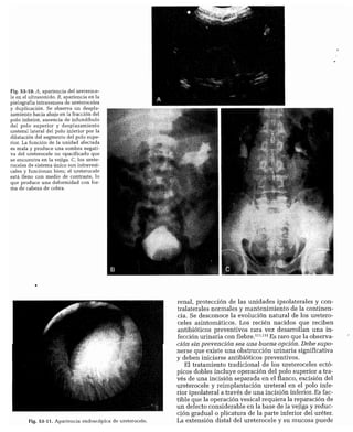 CLINICA QUIRURGICA - Cirugia pediatrica   ashcraft