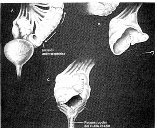 CLINICA QUIRURGICA - Cirugia pediatrica   ashcraft