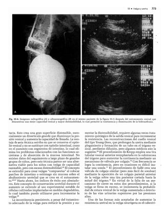 CLINICA QUIRURGICA - Cirugia pediatrica   ashcraft