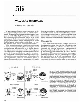 CLINICA QUIRURGICA - Cirugia pediatrica   ashcraft