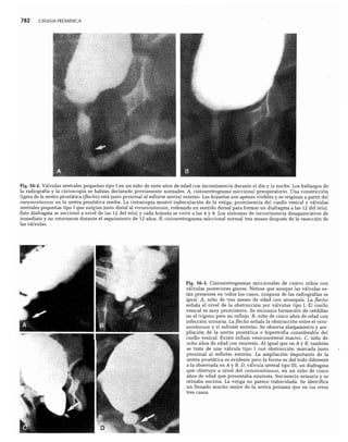 CLINICA QUIRURGICA - Cirugia pediatrica   ashcraft