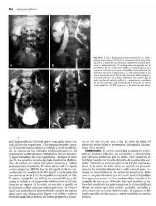 CLINICA QUIRURGICA - Cirugia pediatrica   ashcraft