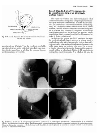 CLINICA QUIRURGICA - Cirugia pediatrica   ashcraft
