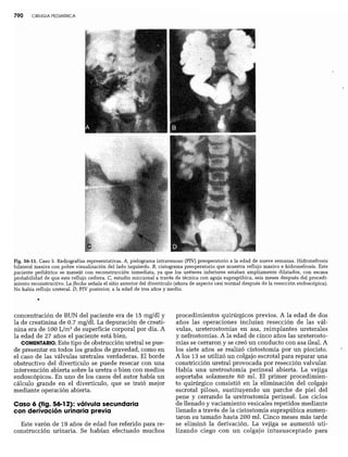CLINICA QUIRURGICA - Cirugia pediatrica   ashcraft