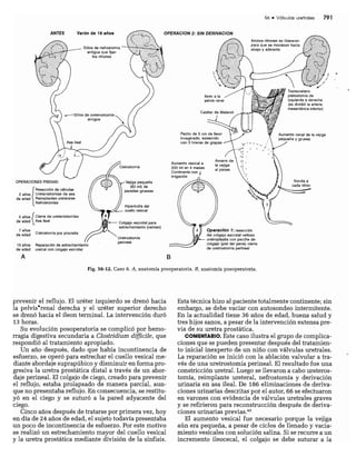 CLINICA QUIRURGICA - Cirugia pediatrica   ashcraft