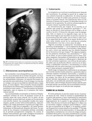 CLINICA QUIRURGICA - Cirugia pediatrica   ashcraft