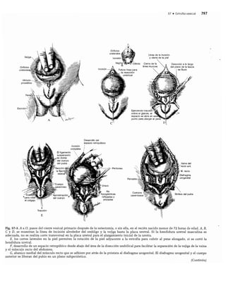 CLINICA QUIRURGICA - Cirugia pediatrica   ashcraft