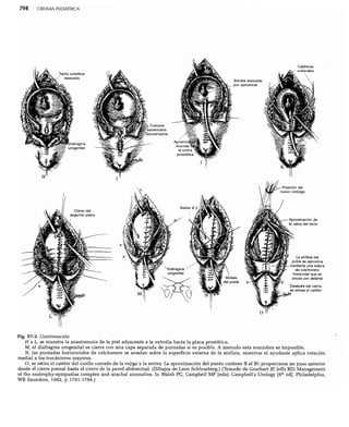 CLINICA QUIRURGICA - Cirugia pediatrica   ashcraft