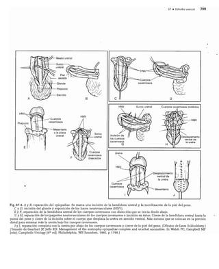 CLINICA QUIRURGICA - Cirugia pediatrica   ashcraft