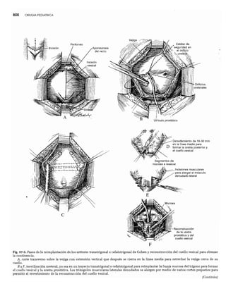 CLINICA QUIRURGICA - Cirugia pediatrica   ashcraft