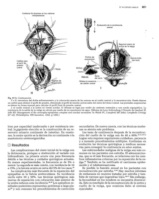 CLINICA QUIRURGICA - Cirugia pediatrica   ashcraft