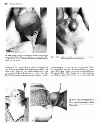 CLINICA QUIRURGICA - Cirugia pediatrica   ashcraft