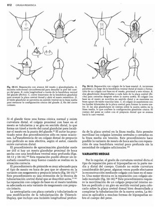 CLINICA QUIRURGICA - Cirugia pediatrica   ashcraft
