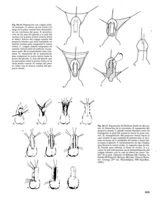 CLINICA QUIRURGICA - Cirugia pediatrica   ashcraft