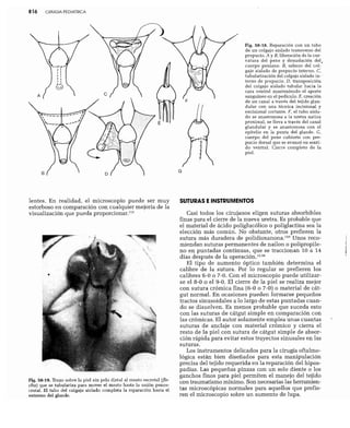 CLINICA QUIRURGICA - Cirugia pediatrica   ashcraft