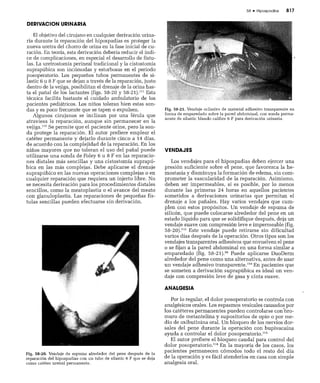 CLINICA QUIRURGICA - Cirugia pediatrica   ashcraft