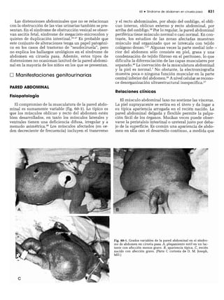 CLINICA QUIRURGICA - Cirugia pediatrica   ashcraft