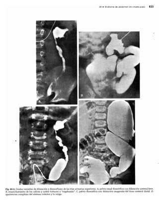 CLINICA QUIRURGICA - Cirugia pediatrica   ashcraft