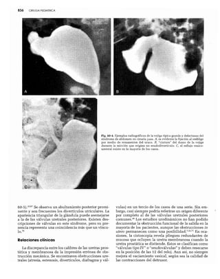 CLINICA QUIRURGICA - Cirugia pediatrica   ashcraft