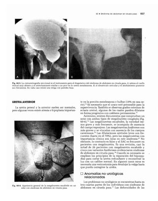 CLINICA QUIRURGICA - Cirugia pediatrica   ashcraft