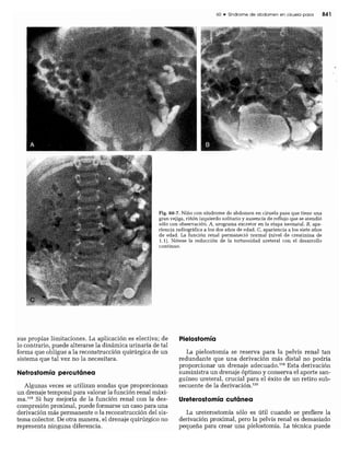 CLINICA QUIRURGICA - Cirugia pediatrica   ashcraft