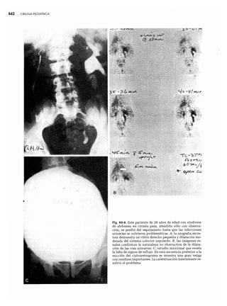 CLINICA QUIRURGICA - Cirugia pediatrica   ashcraft