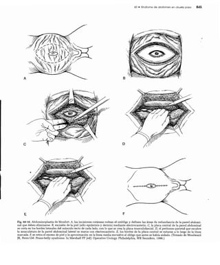 CLINICA QUIRURGICA - Cirugia pediatrica   ashcraft