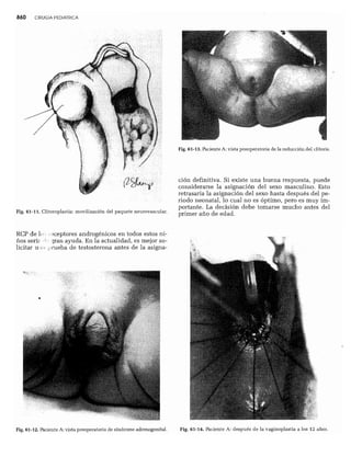 CLINICA QUIRURGICA - Cirugia pediatrica   ashcraft