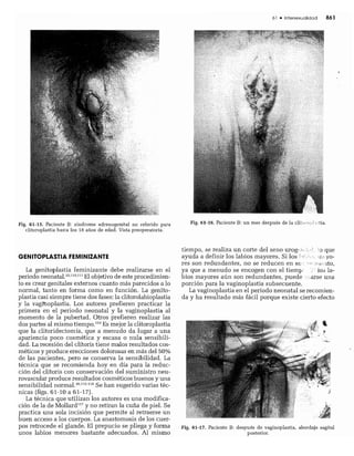CLINICA QUIRURGICA - Cirugia pediatrica   ashcraft