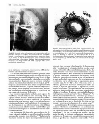 CLINICA QUIRURGICA - Cirugia pediatrica   ashcraft