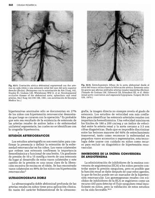 CLINICA QUIRURGICA - Cirugia pediatrica   ashcraft