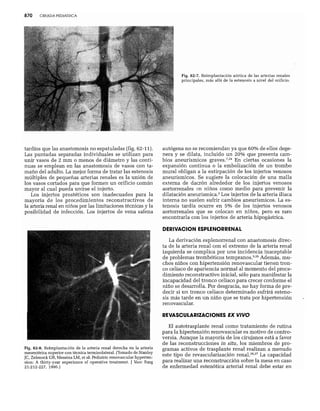CLINICA QUIRURGICA - Cirugia pediatrica   ashcraft