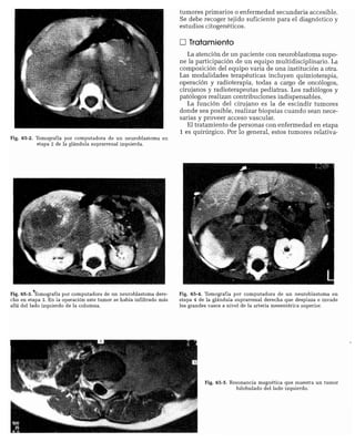 CLINICA QUIRURGICA - Cirugia pediatrica   ashcraft