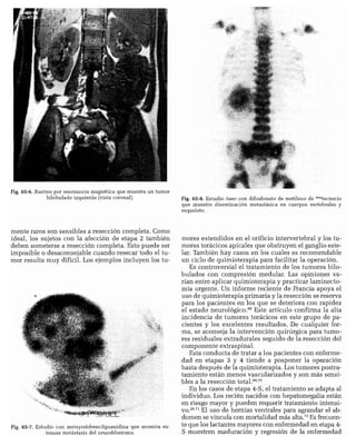 CLINICA QUIRURGICA - Cirugia pediatrica   ashcraft