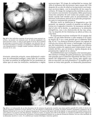 CLINICA QUIRURGICA - Cirugia pediatrica   ashcraft