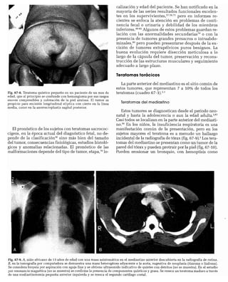 CLINICA QUIRURGICA - Cirugia pediatrica   ashcraft