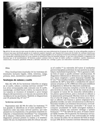 CLINICA QUIRURGICA - Cirugia pediatrica   ashcraft