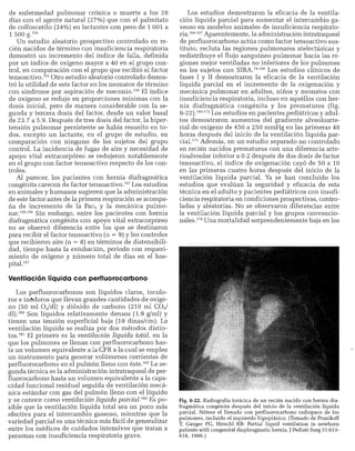 CLINICA QUIRURGICA - Cirugia pediatrica   ashcraft