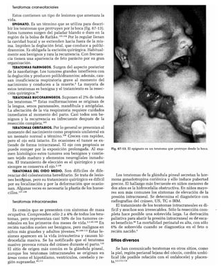 CLINICA QUIRURGICA - Cirugia pediatrica   ashcraft