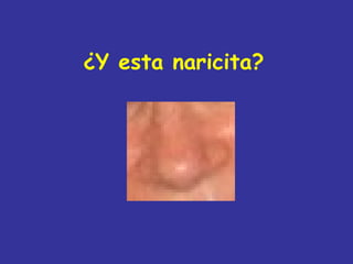 ¿Y esta naricita?
 