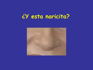 ¿Y esta naricita?
 