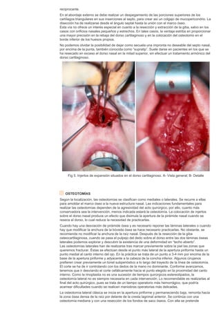Cirugia plastica secpre