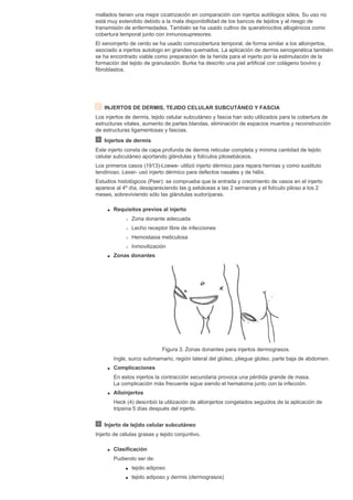 mallados tienen una mejor cicatrización en comparación con injertos autólogos sólos. Su uso no
está muy extendido debido a la mala disponibillidad de los bancos de tejidos y al riesgo de
transmisión de enfermedades. También se ha usado cultivo de queratinocitos allogénicos como
cobertura temporal junto con inmunosupresores.
El xenoinjerto de cerdo se ha usado comocobertura temporal, de forma similar a los alloinjertos,
asociado a injertos autologo en grandes quemados. La aplicación de dermis xenogenética también
se ha encontrado viable como preparación de la herida para el injerto por la estimulación de la
formación del tejido de granulación. Burke ha descrito una piel artificial con colágeno bovino y
fibroblastos.
INJERTOS DE DERMIS, TEJIDO CELULAR SUBCUTÁNEO Y FASCIA
Los injertos de dermis, tejido celular subcutáneo y fascia han sido utilizados para la cobertura de
estructuras vitales, aumento de partes blandas, eliminación de espacios muertos y reconstrucción
de estructuras ligamentosas y fascias.
Injertos de dermis
Este injerto consta de capa profunda de dermis reticular completa y mínima cantidad de tejido
celular subcutáneo aportando glándulas y folículos pilosebáceos.
Los primeros casos (1913)-Loewe- utilizó injerto dérmico para repara hernias y como sustituto
tendinoso. Lexer- usó injerto dérmico para defectos nasales y de hélix.
Estudios histológicos (Peer): se comprueba que la entrada y crecimiento de vasos en el injerto
aparece al 4º día, desapareciendo las g.sebáceas a las 2 semanas y el folículo piloso a los 2
meses, sobreviviendo sólo las glándulas sudoríparas.
q Requisitos previos al injerto
r Zona donante adecuada
r Lecho receptor libre de infecciones
r Hemostasia meticulosa
r Inmovilización
q Zonas donantes
Figura 3. Zonas donantes para injertos dermograsos.
Ingle, surco submamario, región lateral del glúteo, pliegue glúteo, parte baja de abdomen.
q Complicaciones
En estos injertos la contracción secundaria provoca una pérdida grande de masa.
La complicación más frecuente sigue siendo el hematoma junto con la infección.
q Alloinjertos
Heck (4) describió la utilización de alloinjertos congelados seguidos de la aplicación de
tripsina 5 días después del injerto.
Injerto de tejido celular subcutáneo
Injerto de células grasas y tejido conjuntivo.
q Clasificación
Pudiendo ser de:
s tejido adiposo
s tejido adiposo y dermis (dermograsos)
 