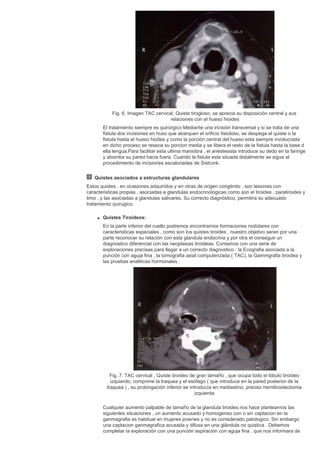 Cirugia plastica secpre