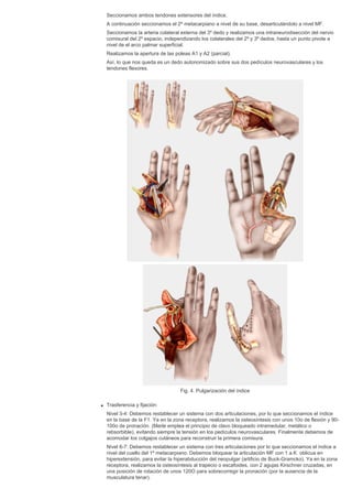 Cirugia plastica secpre