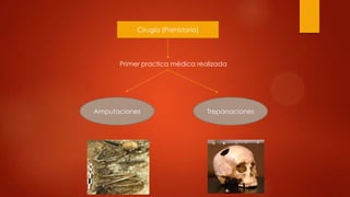 Cirugía (Prehistoria)
Primer practica médica realizada
Amputaciones Trepanaciones
 
