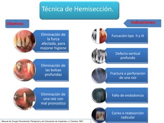 Cirugia Pre Protesica Final