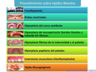 Cirugia Pre Protesica Final